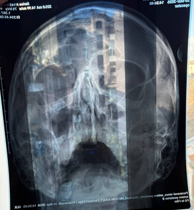 напад корови tweet media