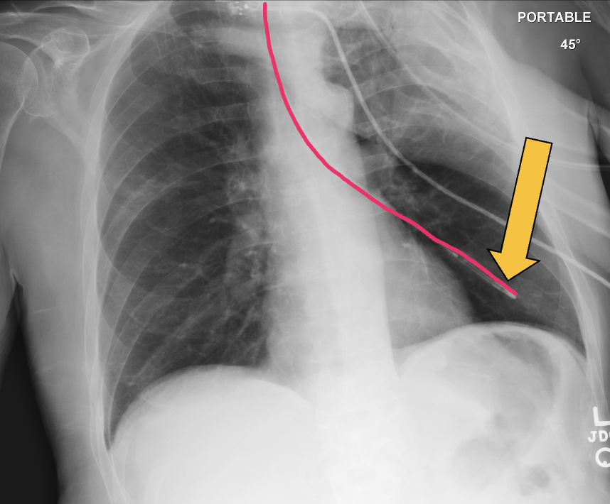 Maddi Wulfeck, MD tweet media