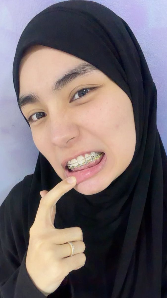 canvasdump's tweet photo. top 1 nosecrunch "grrrrh" pose masi dipegang rania gasi?
it's her trademark pose i believe💁‍♂️ https://t.co/KJHZAycW0k