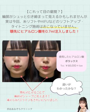 ゆき先生@婦人科形成 tweet media