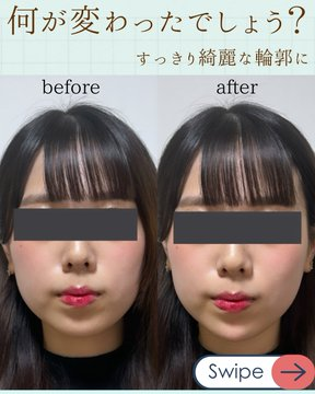 ゆき先生@婦人科形成 tweet media