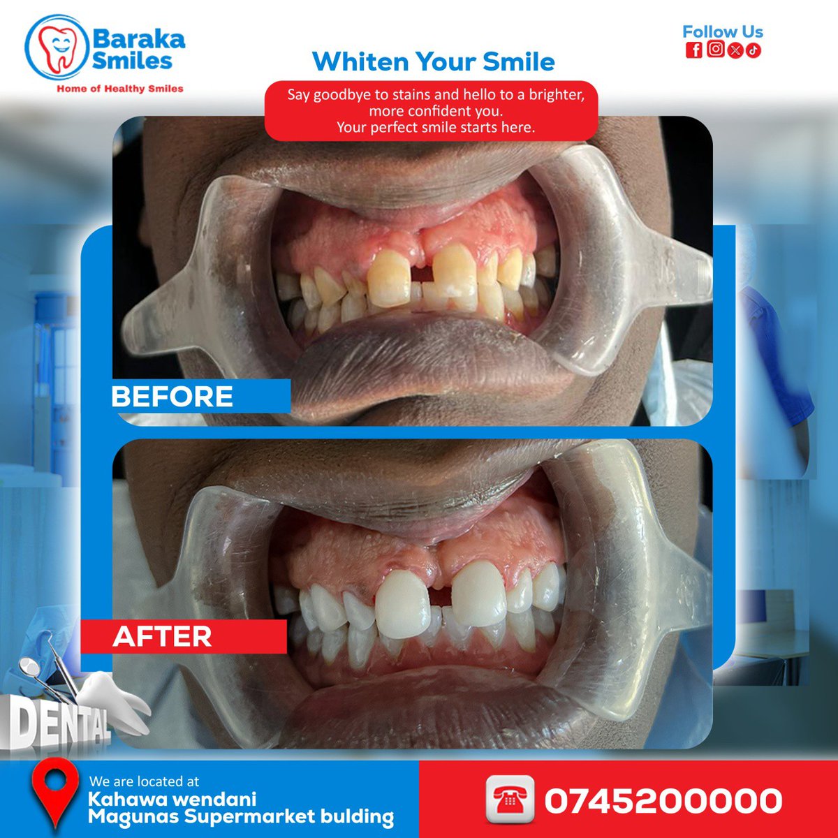 Baraka Smiles Dental Clinic tweet media