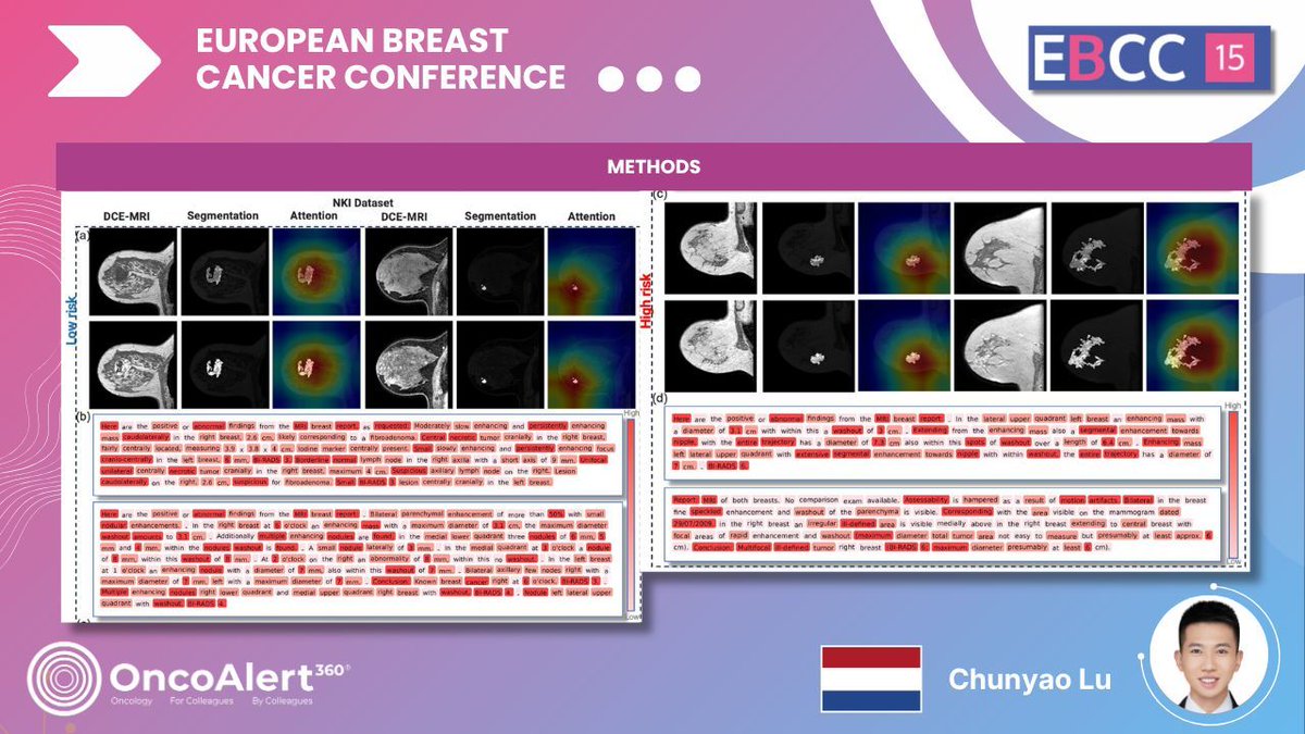 OncoAlert tweet media