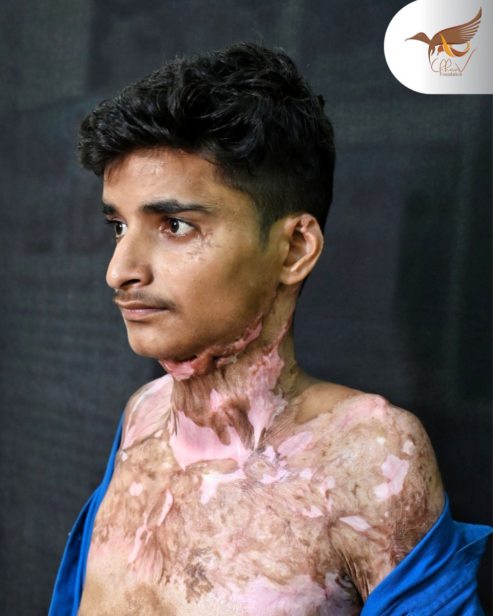 Stop Acid Attacks tweet media