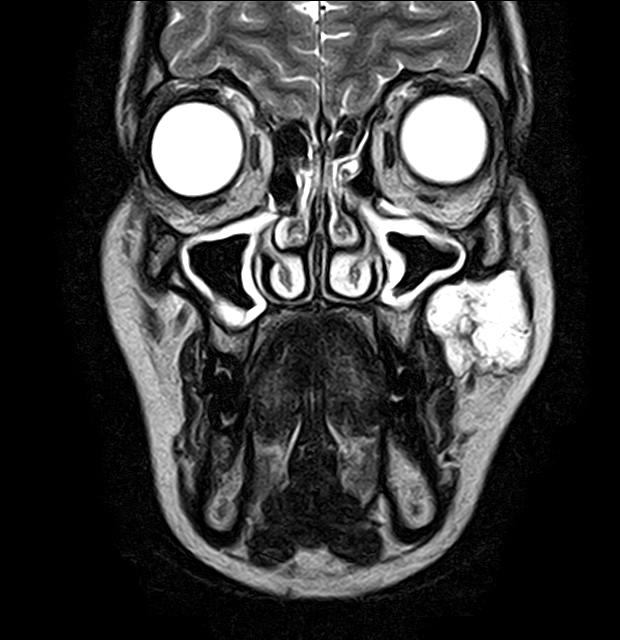 Scaley Randy tweet media