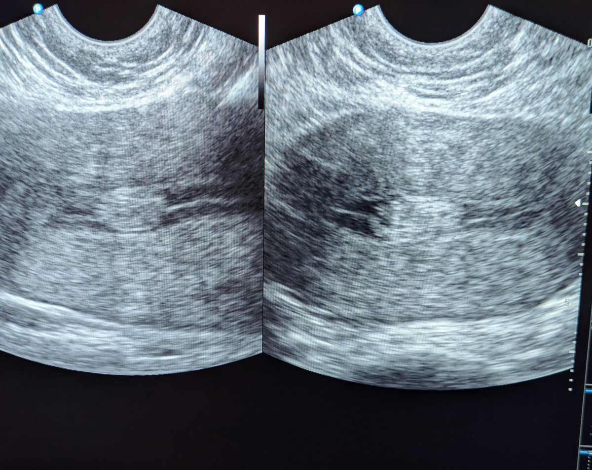 Bruno Natuhwera tweet media