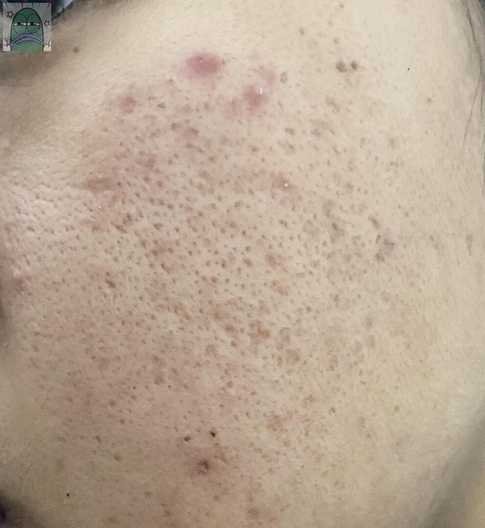 Tanyarlfes tweet media