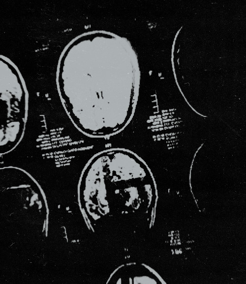 ๐๐๐๐๐ ฯบ.โ
tweet media