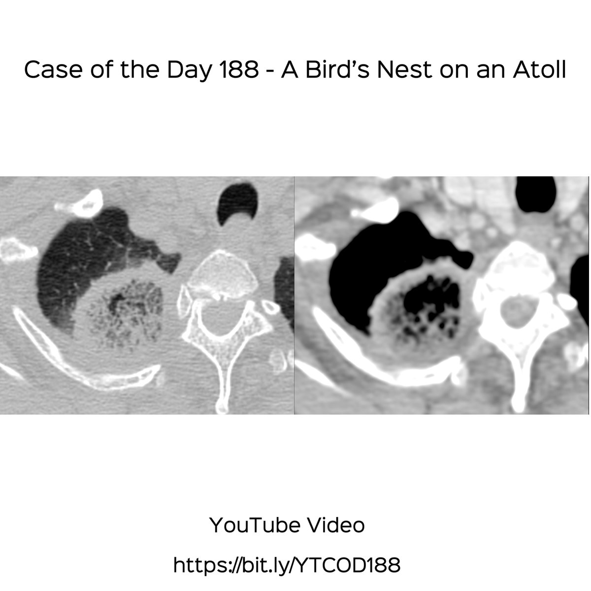 Bhavin Jankharia tweet media