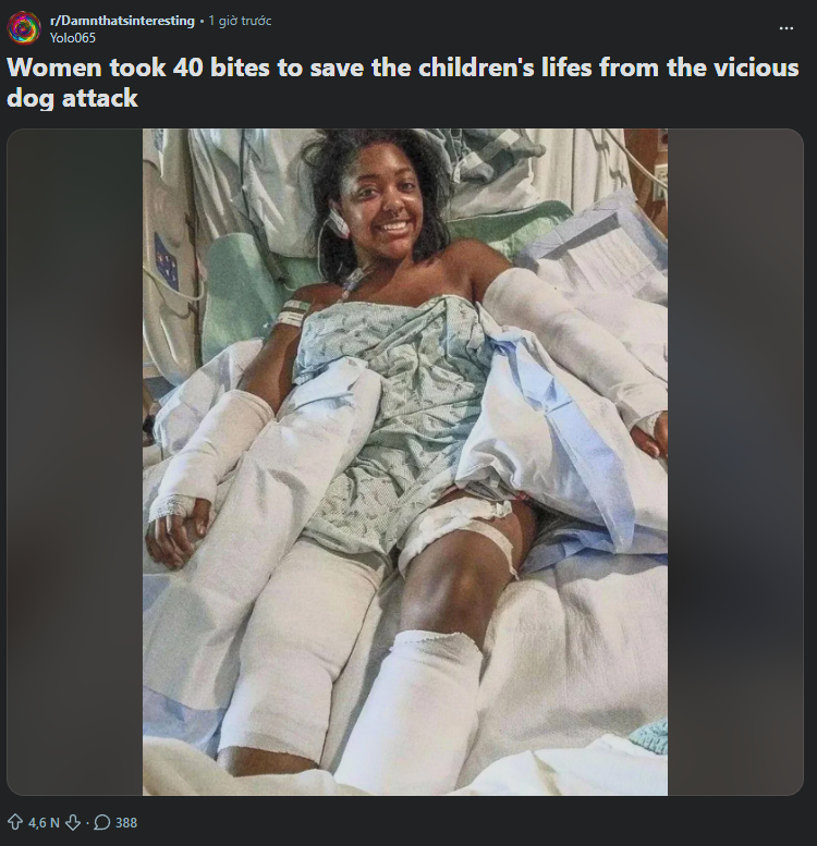 HkdHtd's tweet photo. This is blowing up on Reddit just check it your self

This girl just got bite 40 times by a pitbull because she used her own body as a shield to protect a 8 month old baby

everyone in the comments call her: "Hero" https://t.co/nBS5p6RtV8