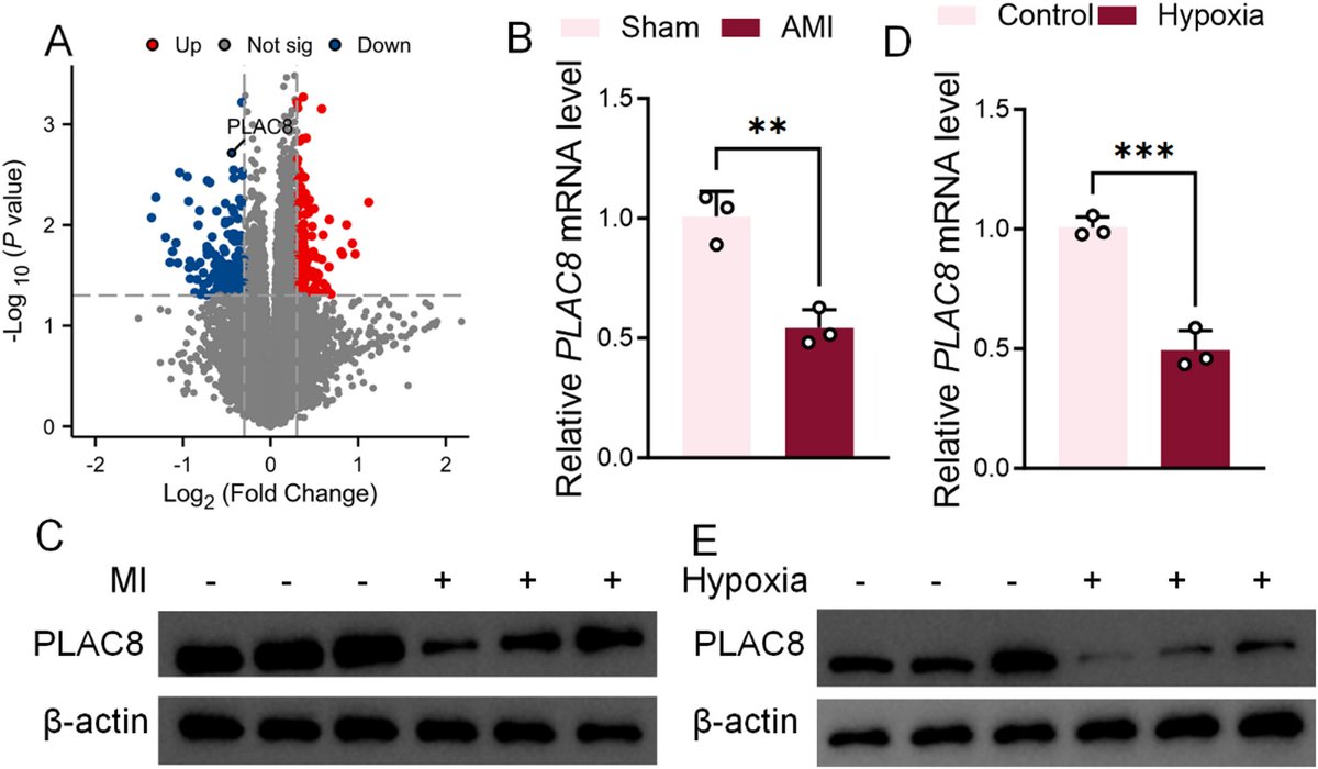 JPBY_official's tweet image. PLAC8 as a potential therapeutic target for myocardial   infarction: unraveling the molecular mechanisms   link.springer.com/article/10.100…
@NCUniv1921
#Myocardial_infarction #PLAC8 #Hypoxia #Apoptosis #MEK_ERK