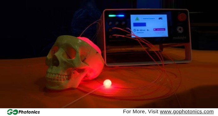 gophotonics's tweet image. Safer laser procedures ahead ⚡

Selective vaporization of polypropylene mesh achieved at 647 nm with minimal thermal impact - opening doors for automated medical laser systems.

Learn more: ow.ly/lv0W50YyZqQ

#Modulight #diode #laser #medical #vaporization #fiber