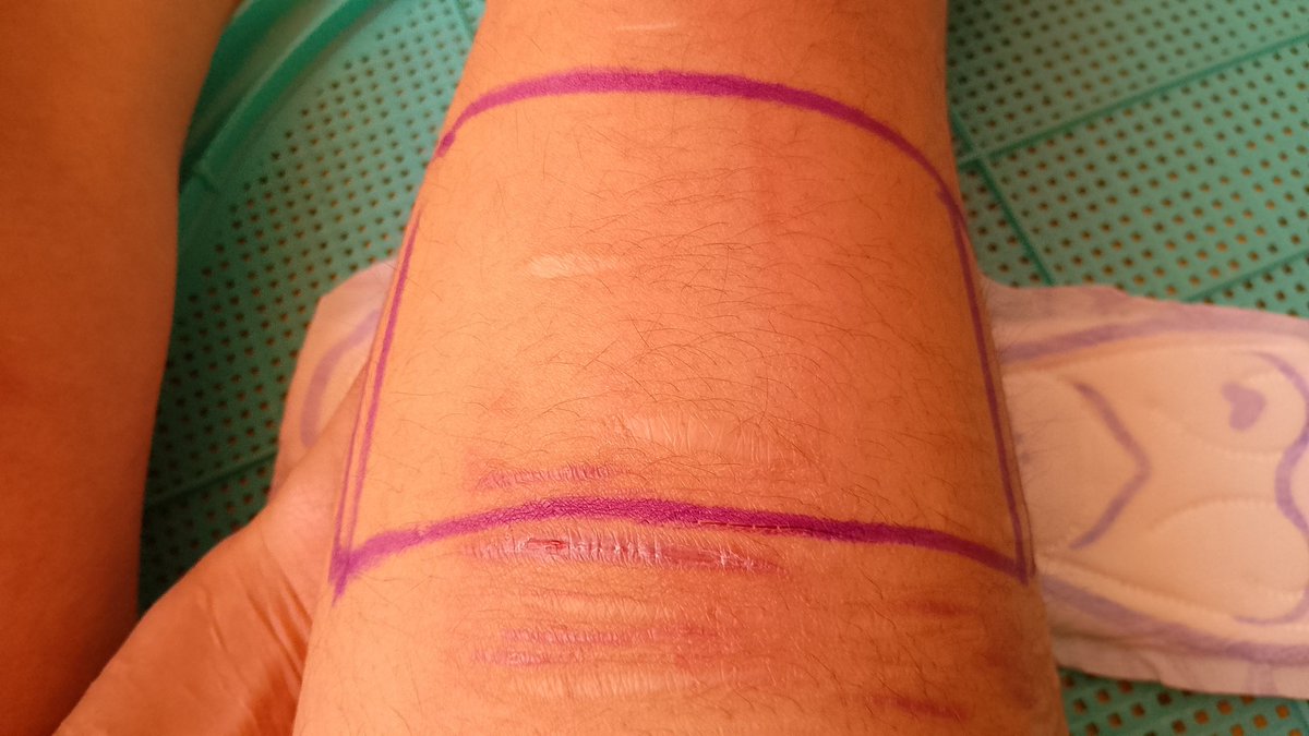 ⚧️𖦹๋࣭⭑ 🍎 Leno & Joy 𐔌 ≽ܫ≼ ꒱ tweet media