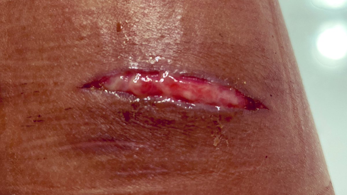 Pony Giorno of shedtwt tweet media