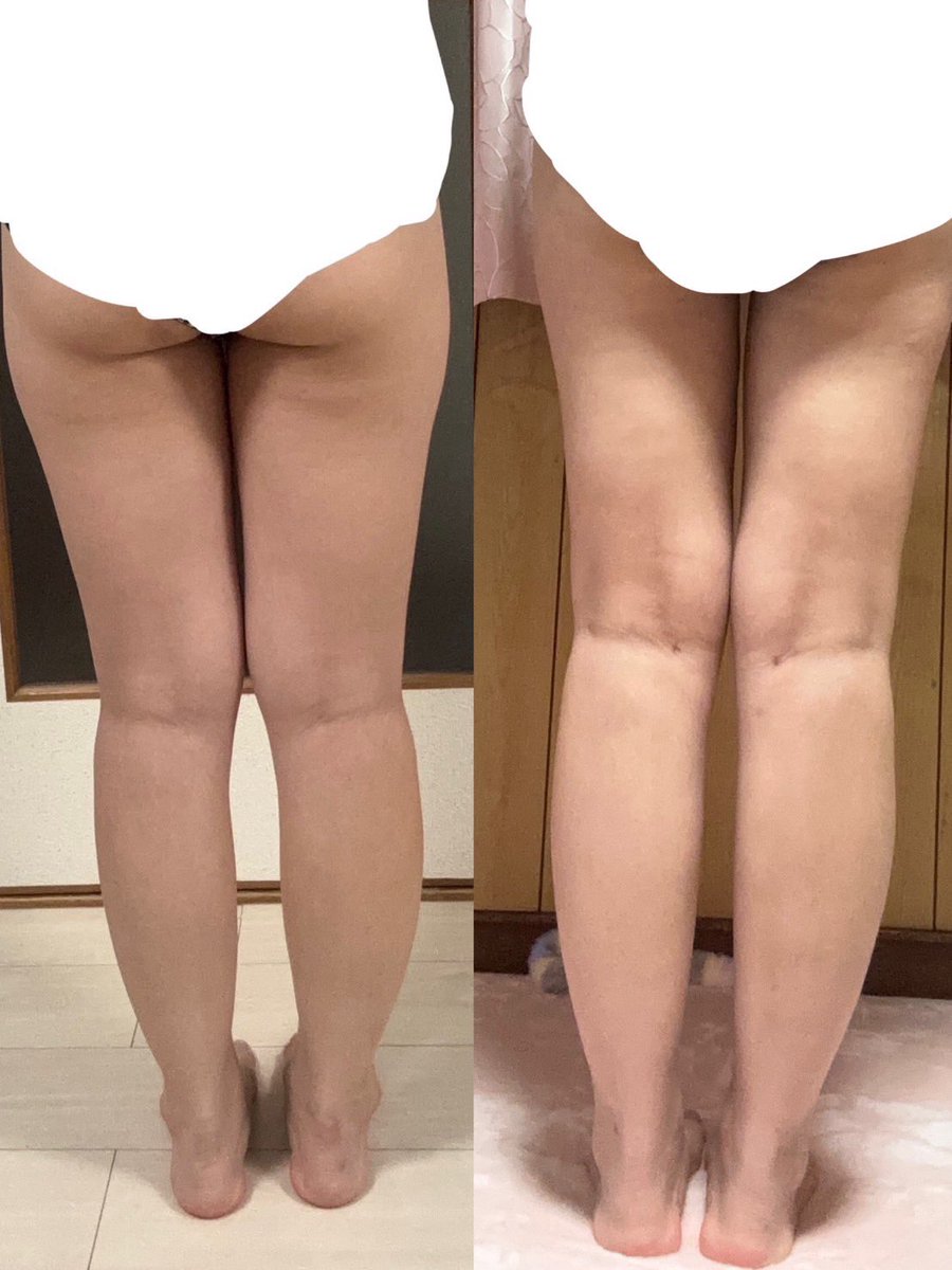 みゃん tweet media