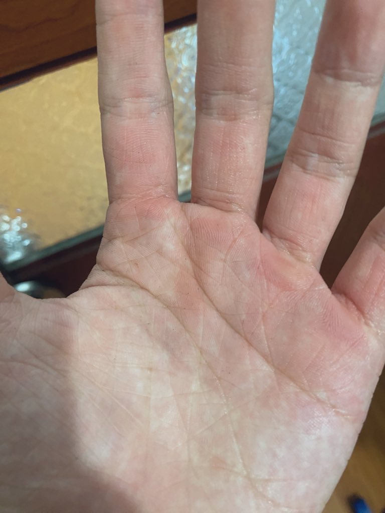 toiyeuphunu tweet media