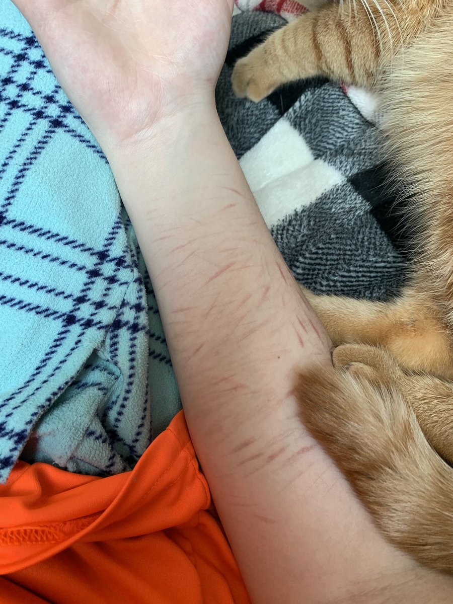 cos / pin 🍃 || shedtwt ( 1 day binge free ) tweet media