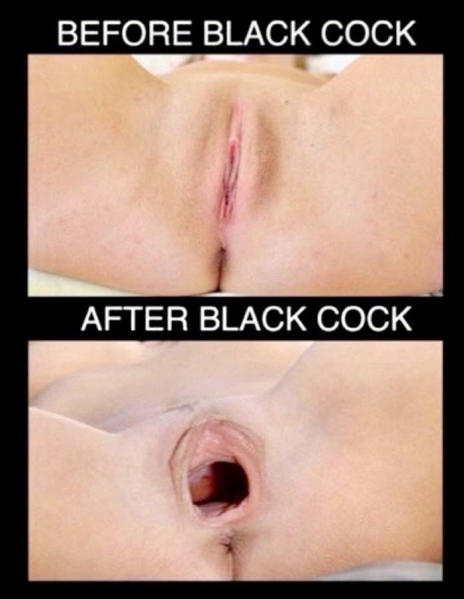 ALPHA BULL tweet media