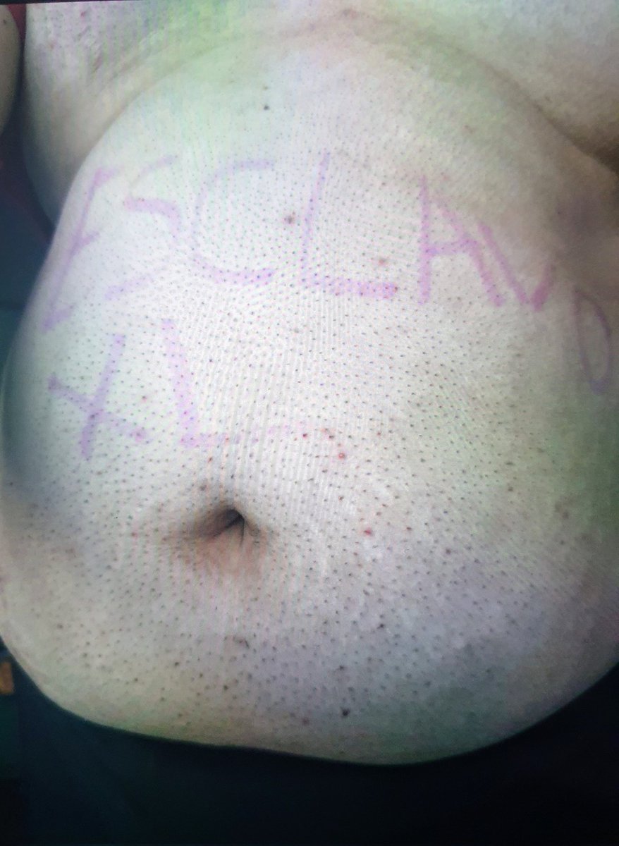 LiamMasterOK's tweet photo. New good boy wants to be my loyal slave 😈⛓️🐶🤏
#slave #findom #fatslave #submissive
#gay https://t.co/TavFWPlHy9
