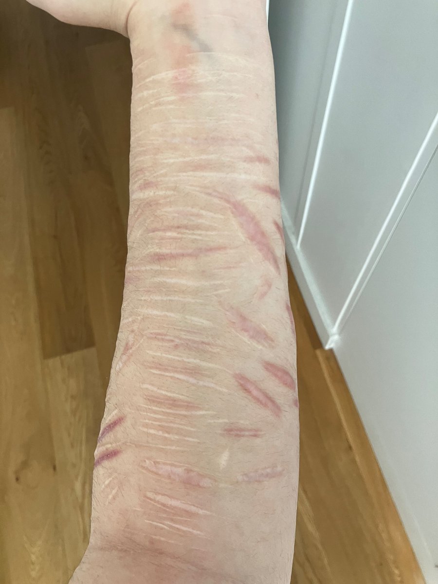 ꧁ 𝓟𝓶𝔃𝓪𝓲 𝓸𝓯 𝓼𝓱𝓮𝓭𝓽𝔀𝓽 ꧂ tweet media