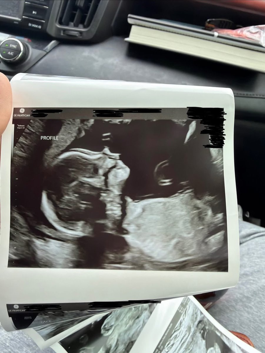 TF | Lurry tweet media