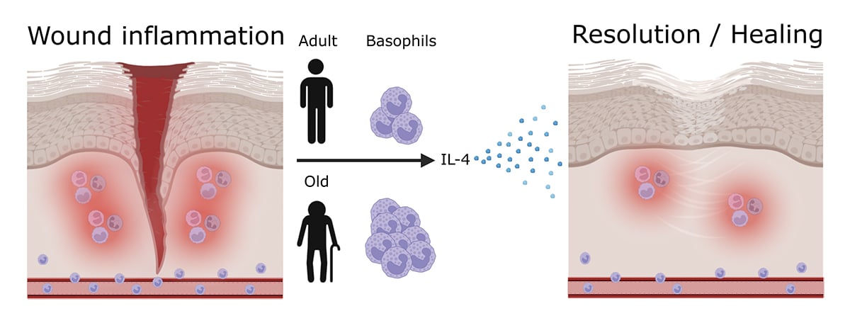JExpMed's tweet image. The resolution of #inflammation is essential for homeostasis and becomes defective with age. Here, Bex, Pellefigues et al. @Inserm show that #basophils infiltrate wounds to promote the resolution and healing in both adult and aged mice. hubs.la/Q048t4-g0