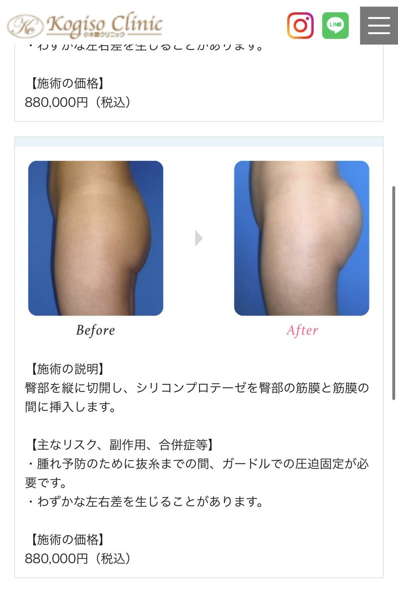 人肉焼肉パーティー🥓 tweet media