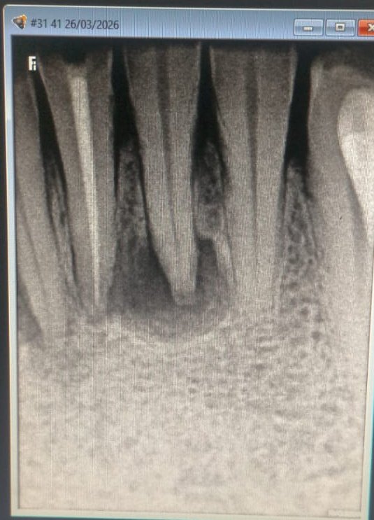 Vital Tooth™ tweet media