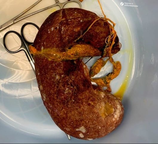 Dr Ihab Suliman tweet media