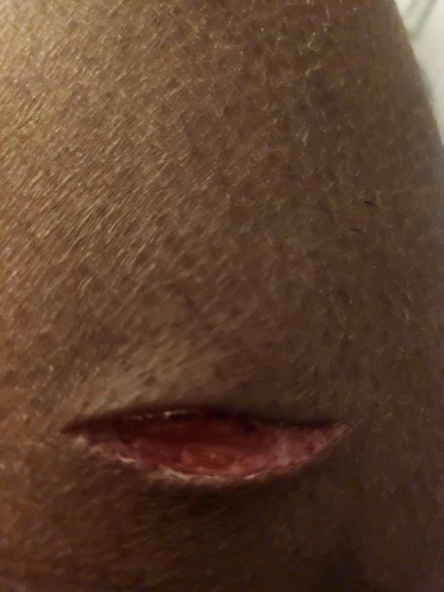 ˚ʚ♡ɞ˚𝑨𝒎𝒐 𝒐𝒇 𝒔𝒉𝒆𝒅 𝒕𝒘𝒕♡ᶜᵃᵐⁱˡˡᵉ˚ʚ♡ɞ˚ tweet media