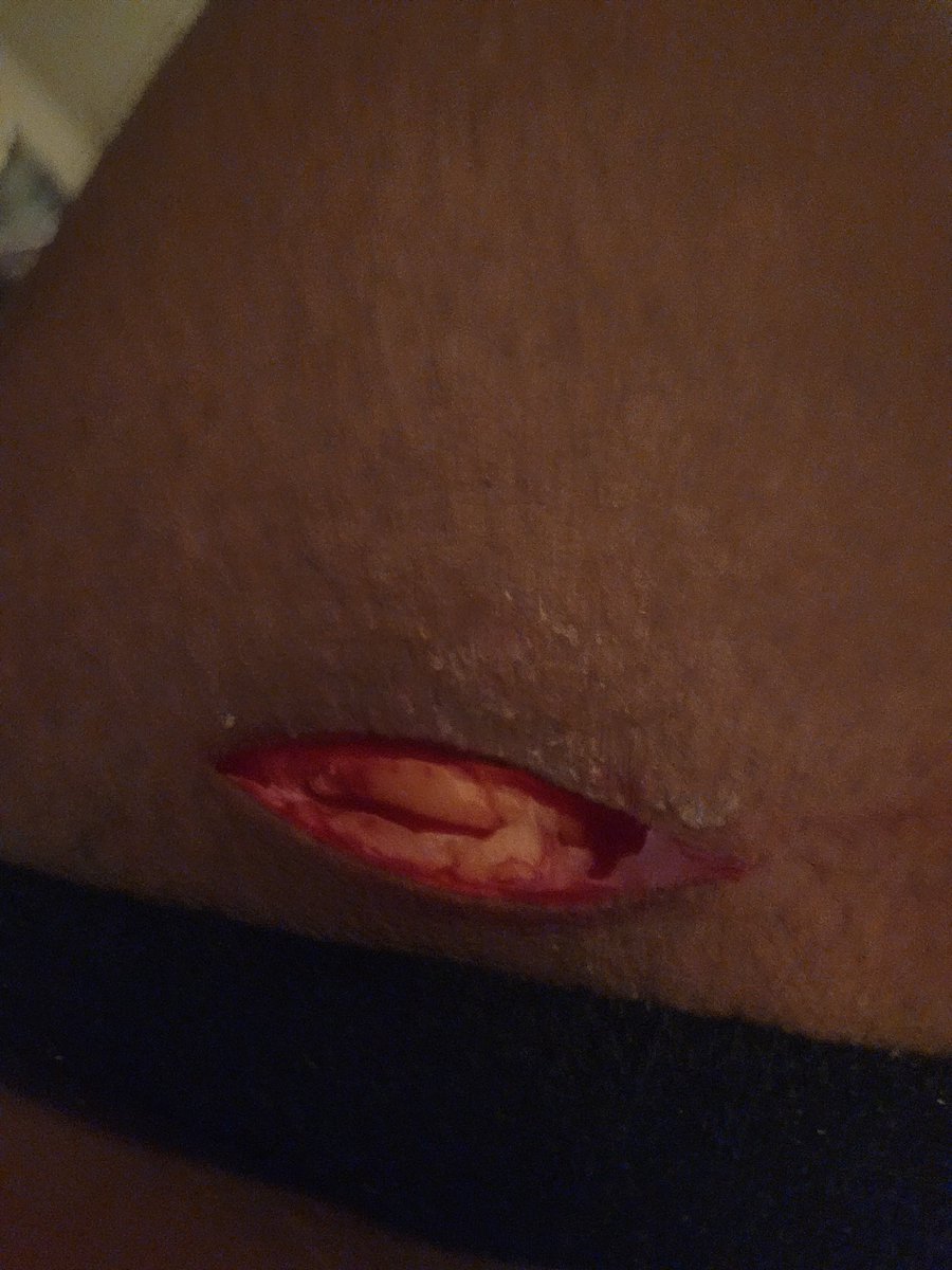 ˚ʚ♡ɞ˚𝑨𝒎𝒐 𝒐𝒇 𝒔𝒉𝒆𝒅 𝒕𝒘𝒕♡ᶜᵃᵐⁱˡˡᵉ˚ʚ♡ɞ˚ tweet media