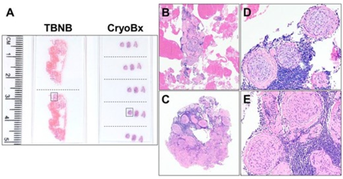 Annals of the ATS tweet media