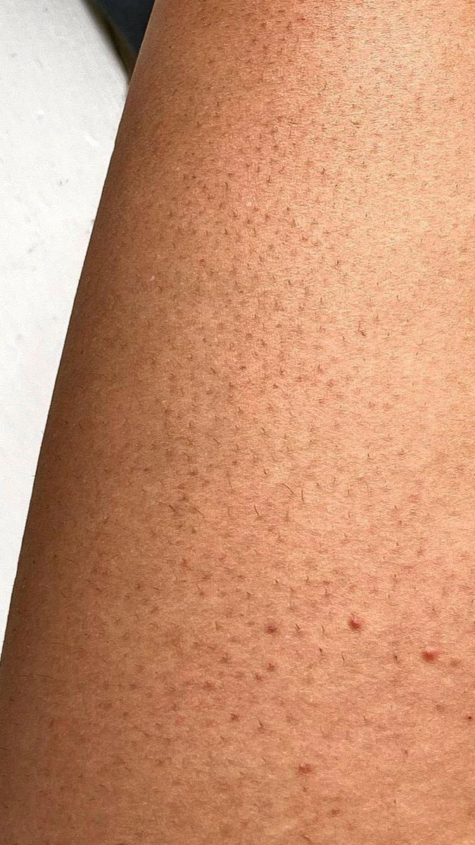 ديـم | DEEM tweet media