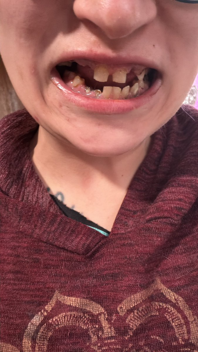 Robin EM-powers patients tweet media