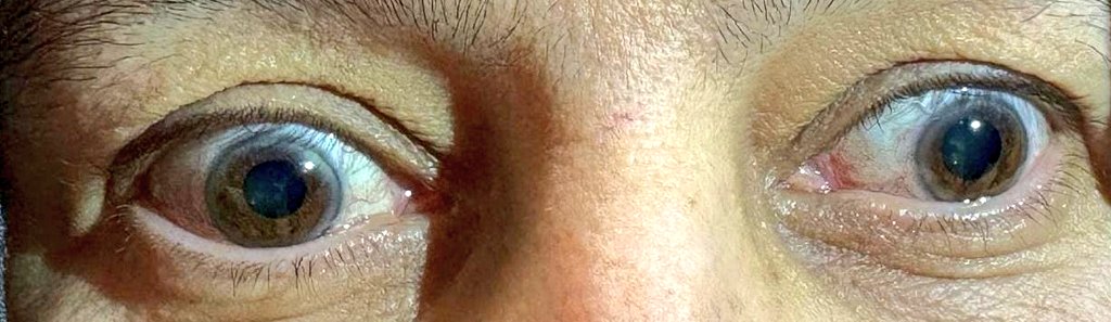 acilsariseron tweet media