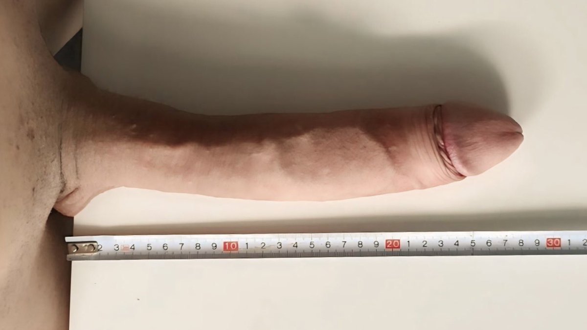 𝙒𝙊𝙍𝙇𝘿 𝙊𝙁 𝙀𝙓𝙋𝙊𝙎𝙀 🌍 tweet media