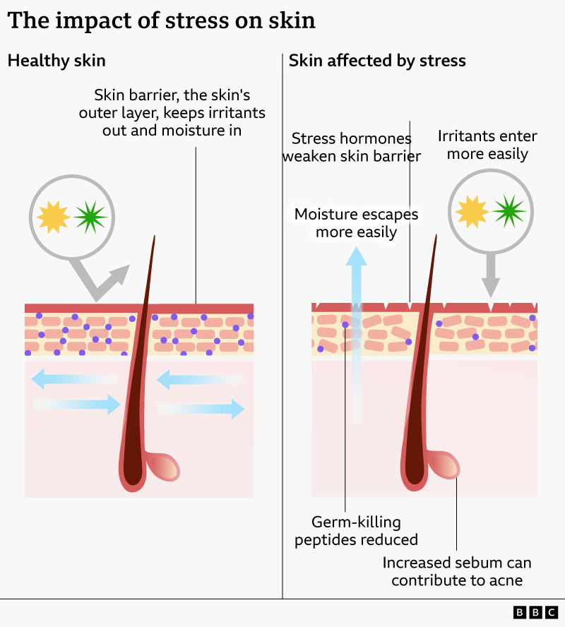 BBC World Service tweet media