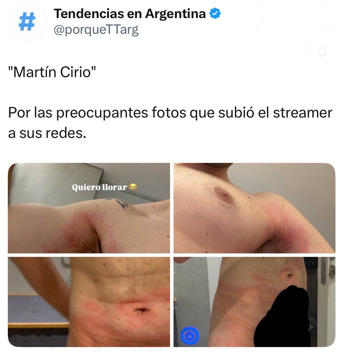 ruu ⋆⋆⋆ tweet media