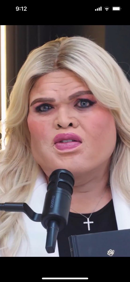 Neuro ﾒ𝟶 🧠 MS,PhDc 🎶Saw Abel 8/15/25🎶 tweet media