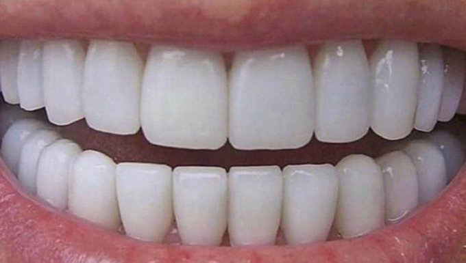 mi fantasía sexual es tener los dientes así