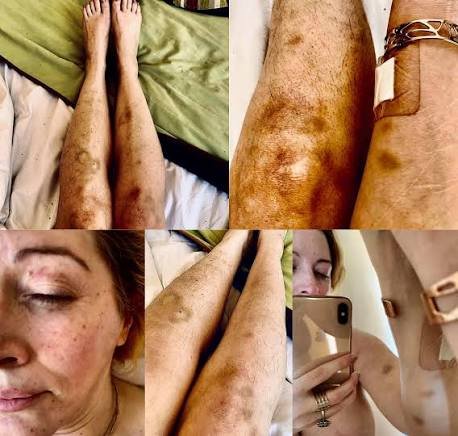 Adalbert Kuruatowska tweet media