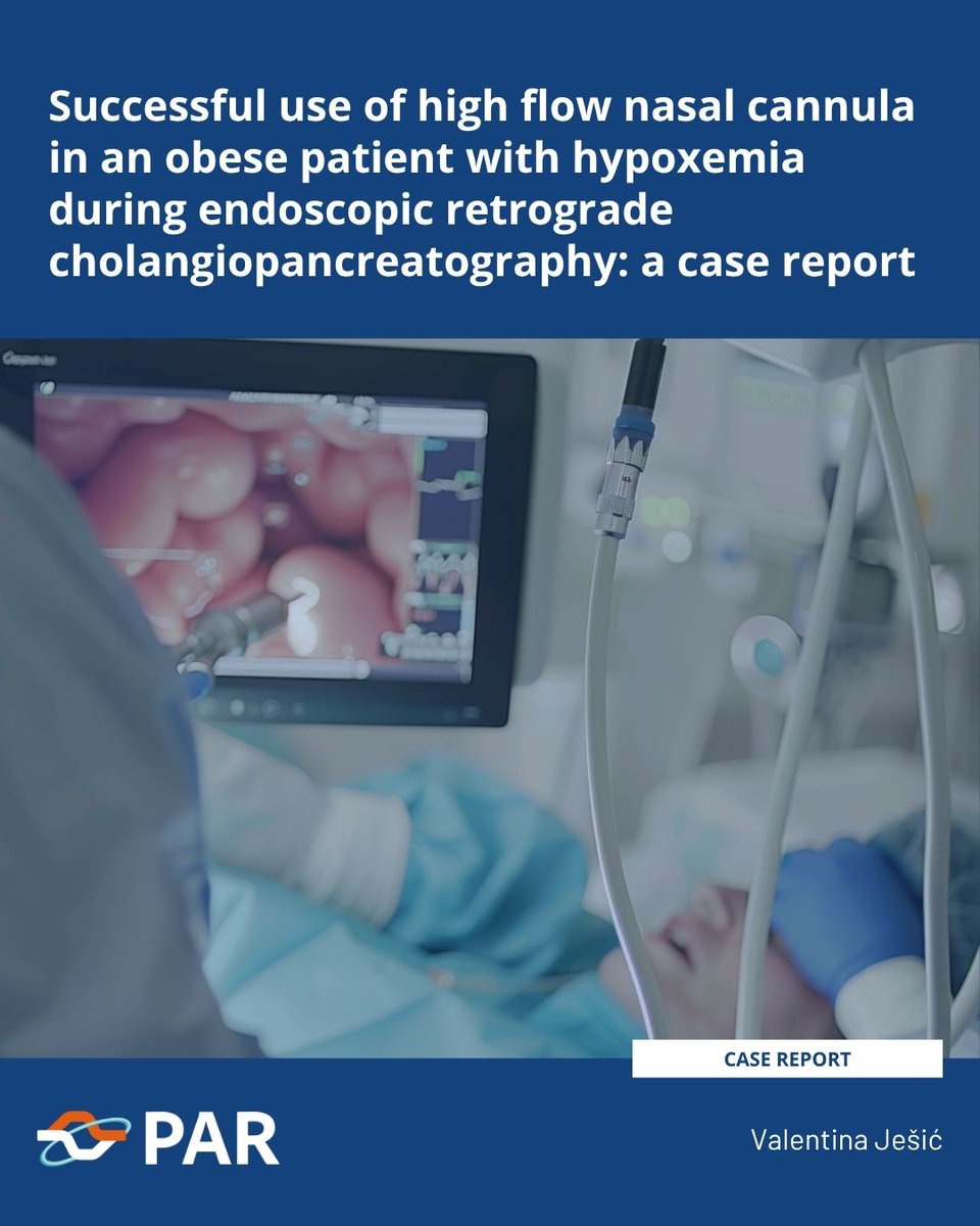 journal_PAR's tweet photo. This case illustrates how high flow nasal cannula oxygen therapy can rapidly reverse severe hypoxemia and enable safe completion of endoscopic retrograde cholangiopancreatography in a high-risk obese patient.
https://t.co/oyjQFQE5d4 https://t.co/RJhUdc8d2U