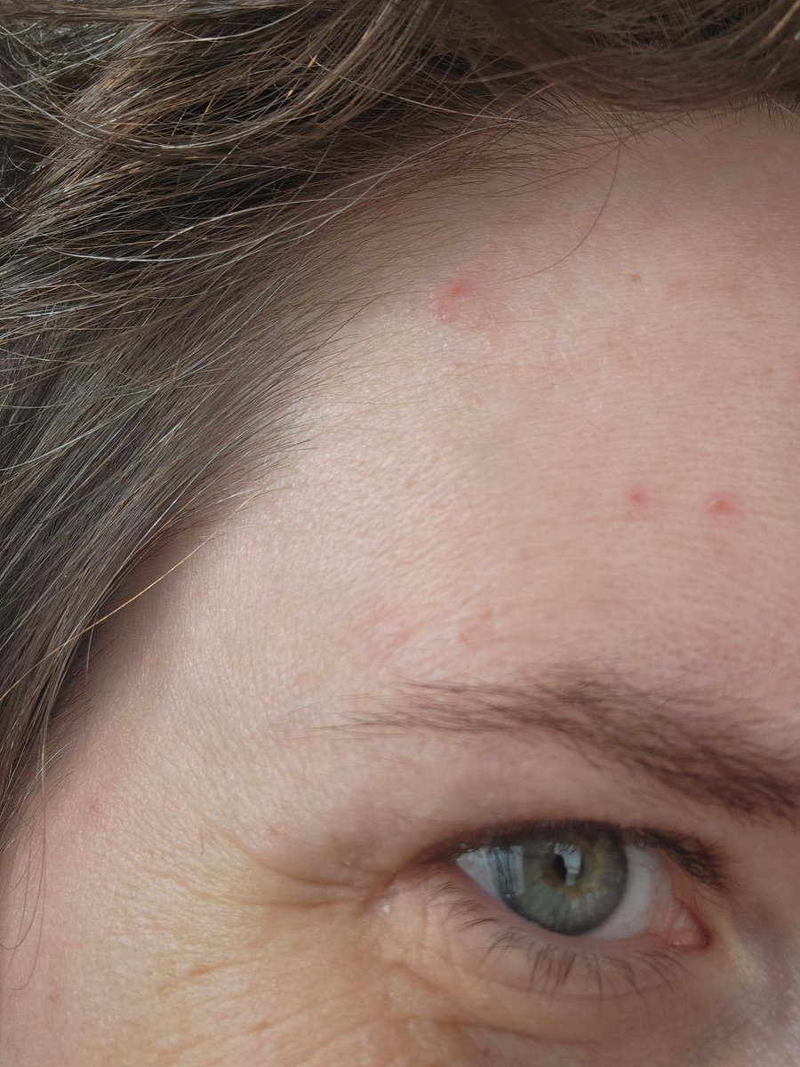 DaemoonCrafts's tweet photo. Today, I’m 25 with 17 years of experience.
You don’t have to do the math. The result will simply show that I’ve been young for a long time.
Also, these aren’t wrinkles or white hairs. They’re just trophies for surviving every patch so far.
And the word “delulu” doesn’t exi— https://t.co/WeoHD7cLFF