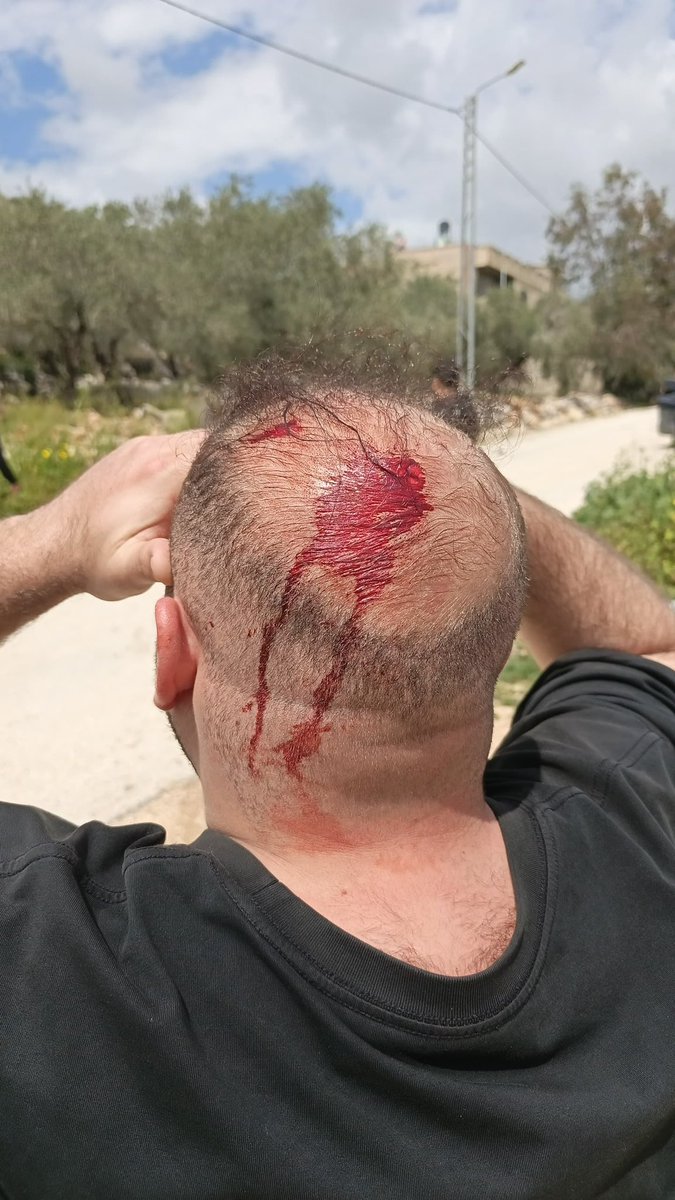 Matan Golan tweet media