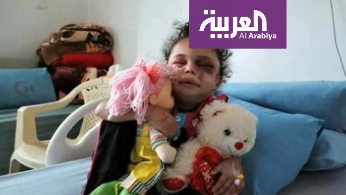 الطفلة بثينة الريمي أيقونة 'عين الإنسانية'

التي نجت وحيدة من مجـ.ـزره ارتكبها العـ.دوان الأمريكي السعودي بحق اسرتها في #صنعاء ..

عجز العالم أمام جرائـ.ـم الحرب في #اليمن.

#اليوم_الوطني_لصمود