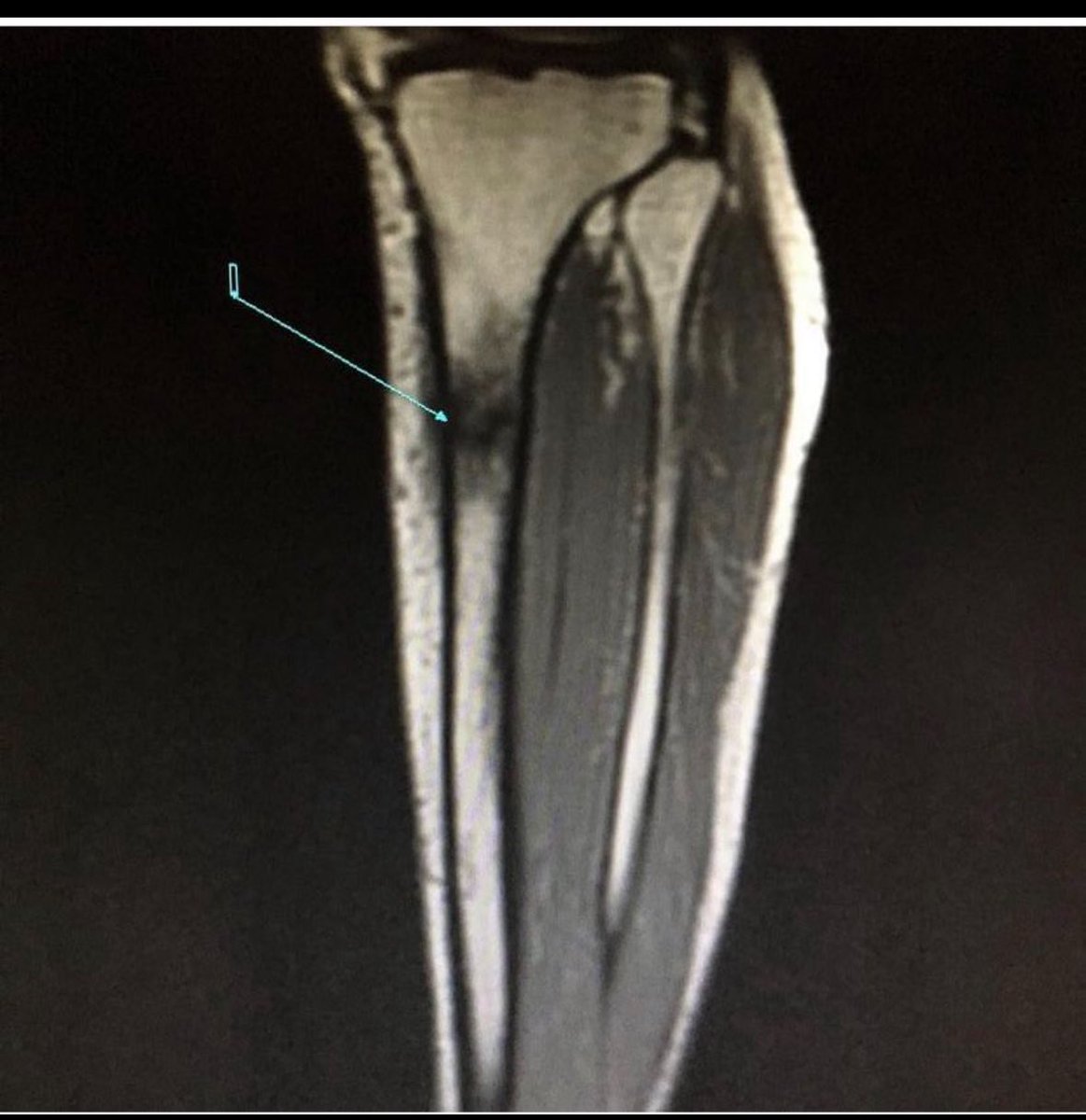 عبدالاله ابن عســاف☢ tweet media