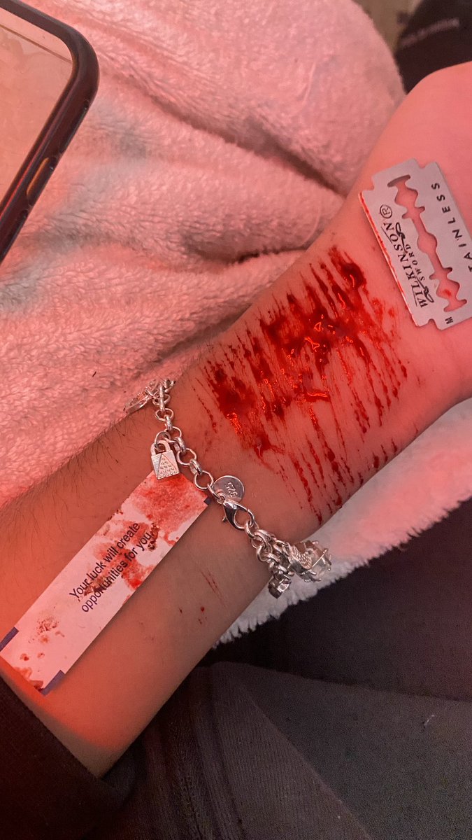 9zsdz0's tweet photo. #slittwt #sh why is my blood not so like not liquid anymore Q-Q https://t.co/hrdohvRZXK