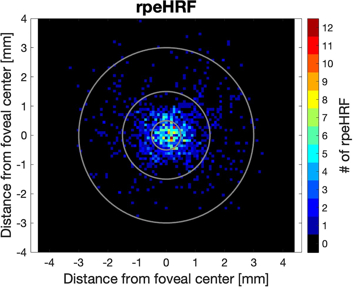 Review of Optometry tweet media