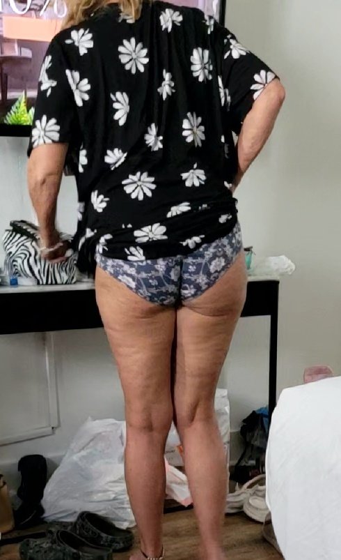 Al_n_Peg3 tweet media