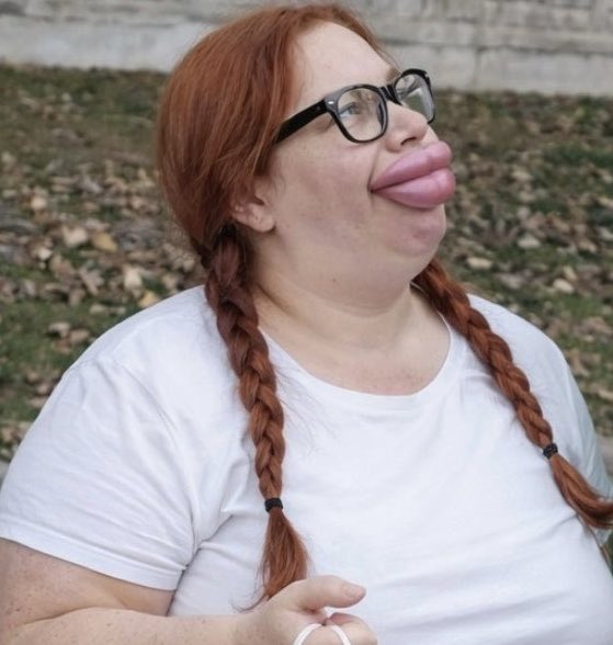 kızıliçe tweet media